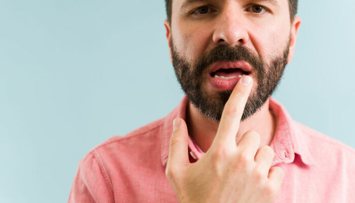 4 common mistakes that make the lips dry and damaged