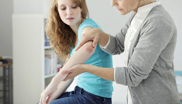 7 common signs of psoriasis