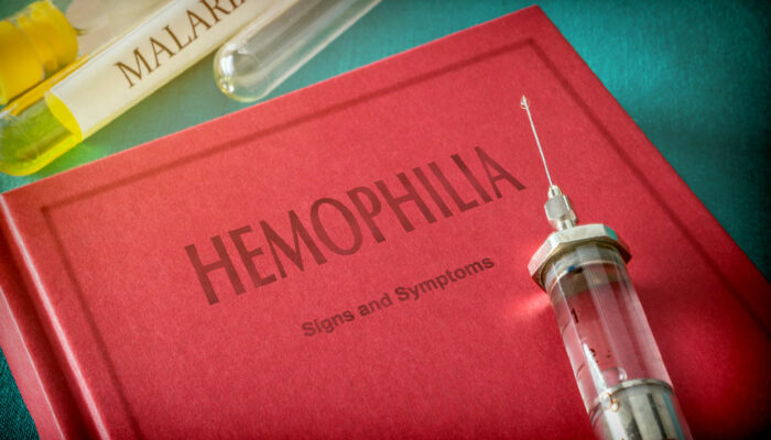 Hemophilia – Symptoms to look out for